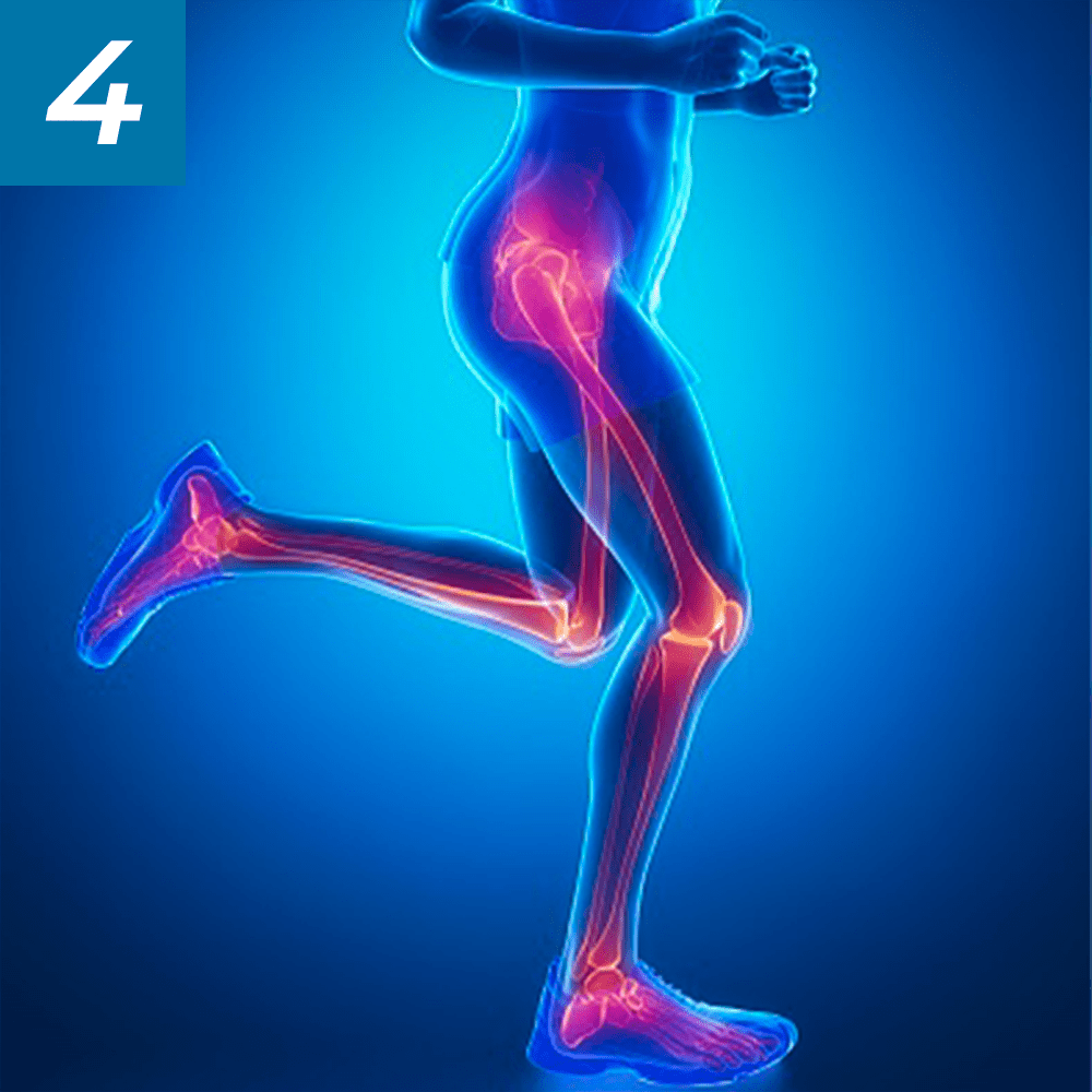 Leg joint support illustration