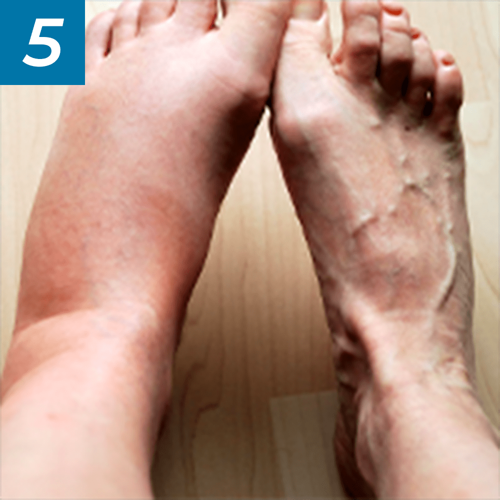 Sensitive feet image